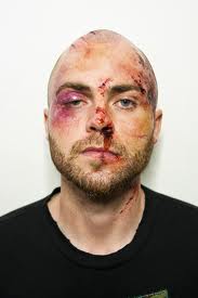 6% of victims are men