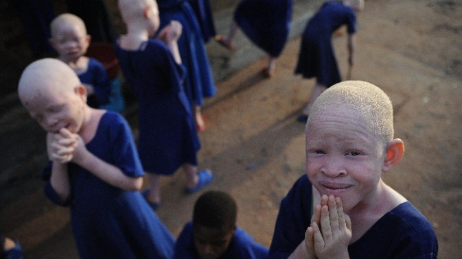 fueled-by-superstition-people-are-violently-attacking-albinos-in-tanzania-1409177333