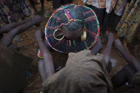 This is the procedure being performed.